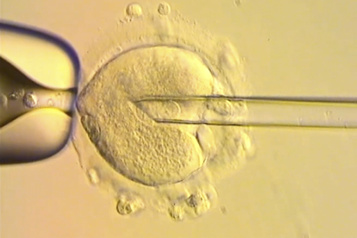 Royaume-Uni Huit bébés naissent avec l’ADN de trois personnes