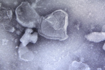  Une découverte montréalaise élucide l’épuisement des cellules immunitaires